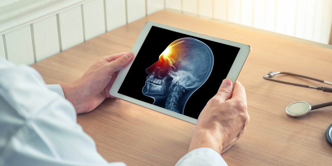 Médico segura um tablet com a imagem de uma cabeça humana com inflamação no cérebro