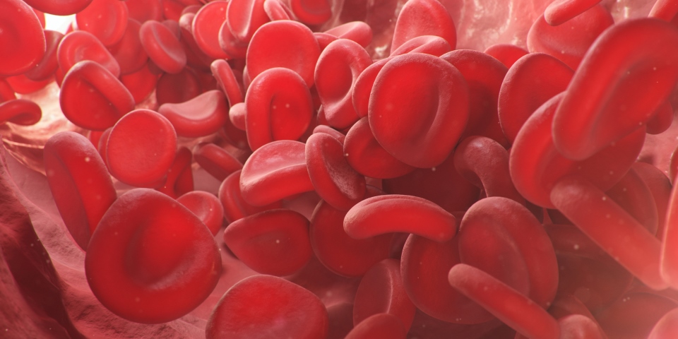 Anemia Falciforme nas células