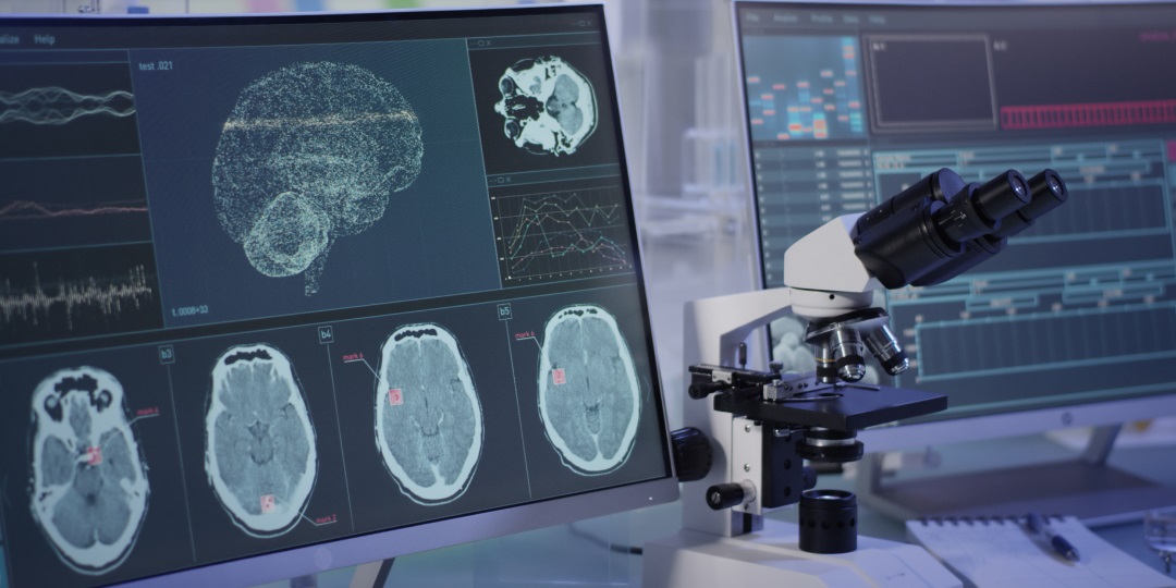 Microscópio e tela com exames cerebrais