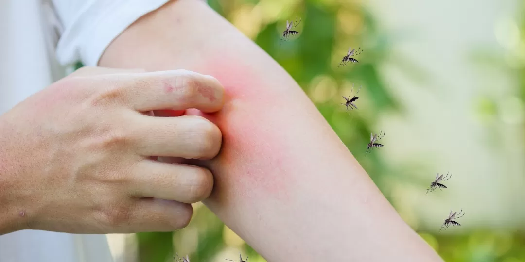 Pessoa coçando o braço com mosquitos voando ao redor