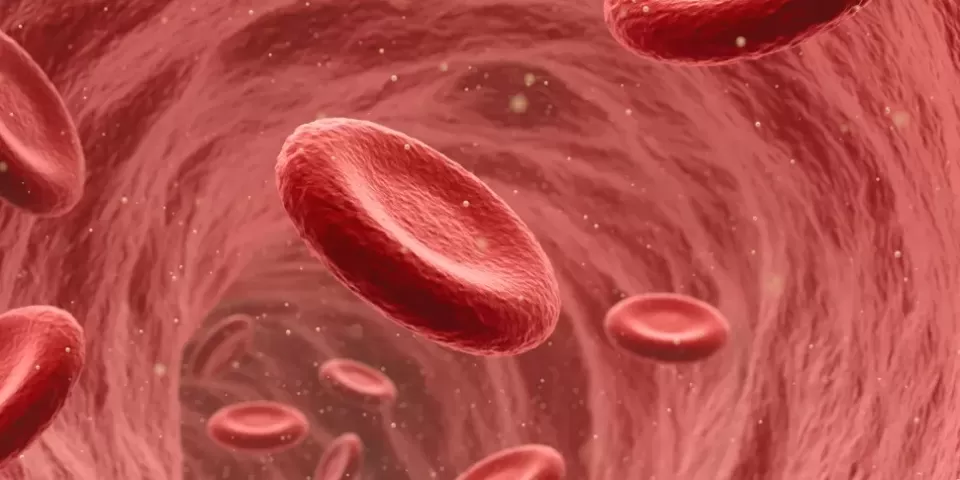 Células do sangue com anemia falciforme